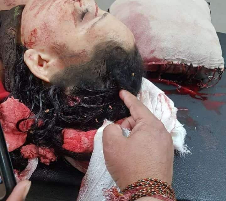 Jammu: A woman died mysteriously when she got hit by a bullet at her residence.