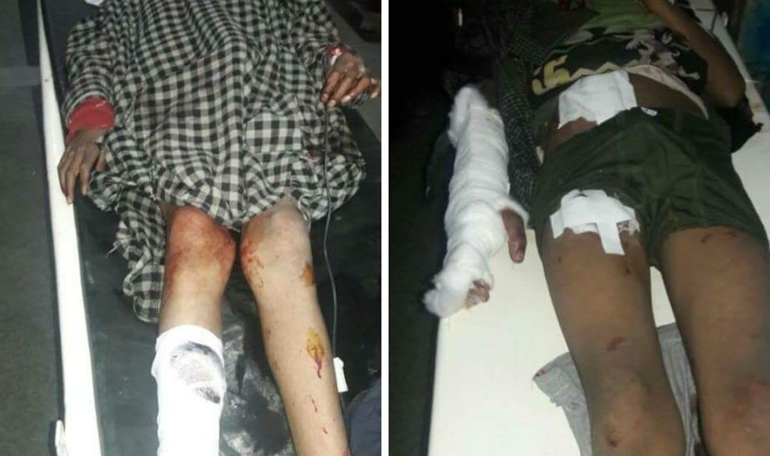 2 minors injured in mysterious blast