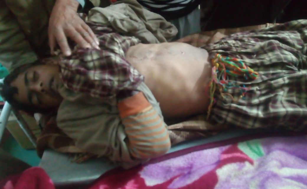 Youth died , 2 others fell unconscious due to lightening At Anantnag