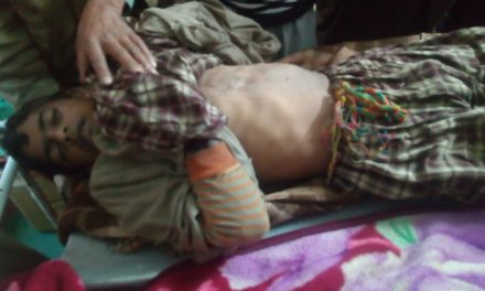 Youth died , 2 others fell unconscious due to lightening At Anantnag