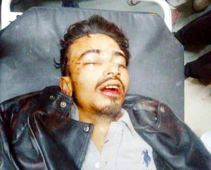 One dead, two injured in a tragic road accident in Ganderbal