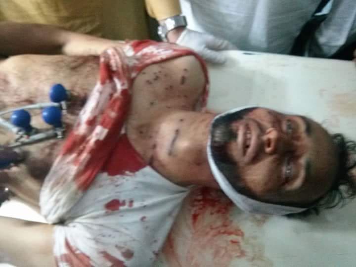 Youth Killed, Over A Dozens Injured In Anantnag Clashes