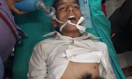 Sopore boy succumbs his injuries