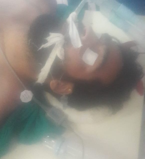 One among two youth tortured by unknown gunmen succumbs in Srinagar hospital