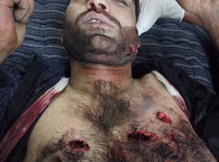 Bullet riddled body of 24-year old youth found in Pulwama village