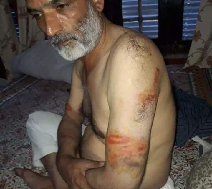 Cops thrash police officer’s father in south Kashmir’s Tral