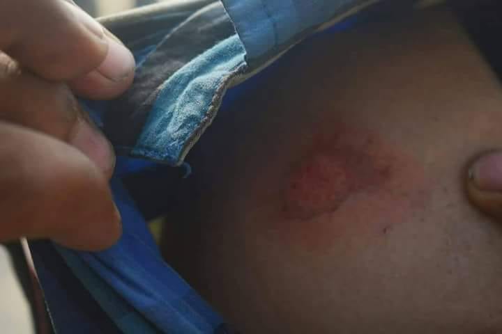 Two journalists thrashed by government forces in Baramulla district