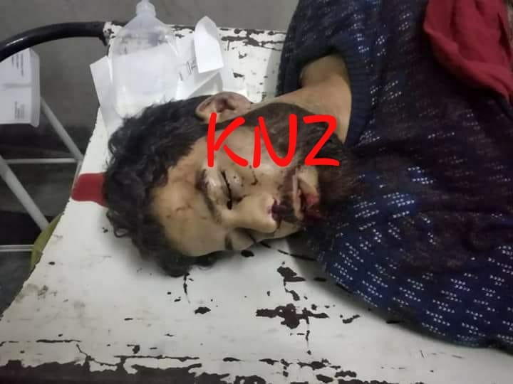 Motorcyclist killed, another injured in Anantnag Sandu road accident.