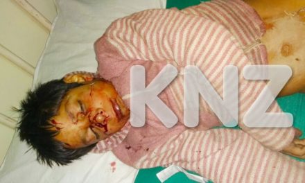 Minor Boy Critically Injured In Road Accident In Ganderbal