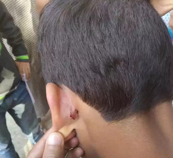 Student ‘thrashed’ by teacher in north Kashmir’s Bandipora, hospitalised