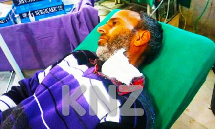 Dog bite cases on rise in Kulgam,Dogs bite 10 persons in a single day