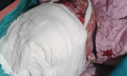 Woman dies, two injured in Sangrama road accident