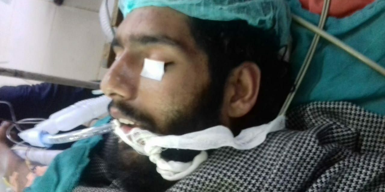 Militant injured critically in Pulwama gunfight admitted in SMHS hospital