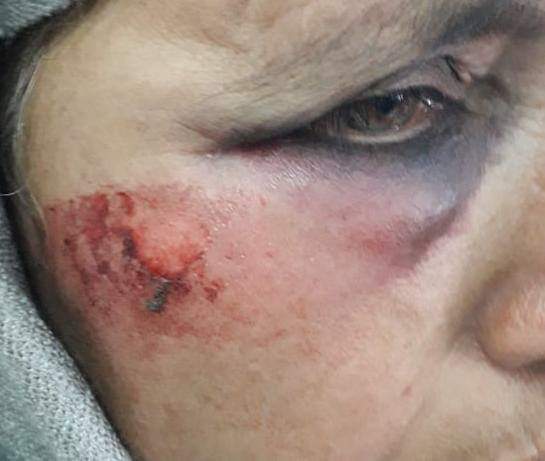 After IED attack, Forces go berserk attacked men and women in South Kashmir village