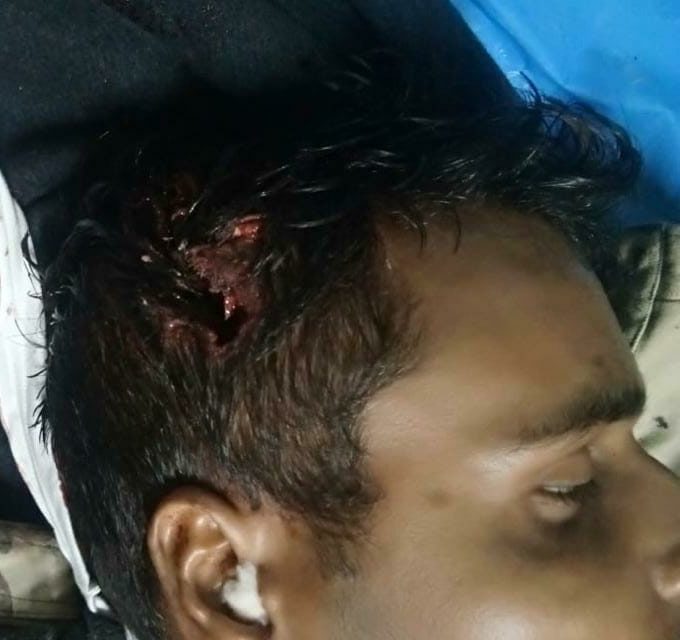 Tral militant attack: Injured SSB personal succumbs in military hospital