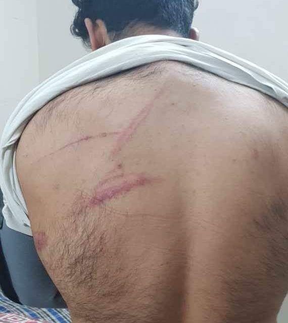 Kashmiri student attacked with knife, iron rods in Chandigarh