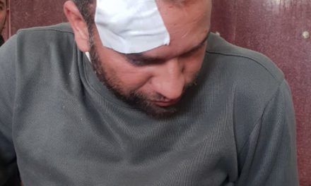 Aijaz Ahmad a noted journalist of shopian was injuried by forces.