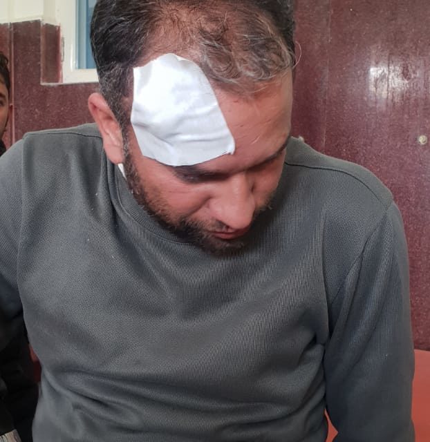 Aijaz Ahmad a noted journalist of shopian was injuried by forces.