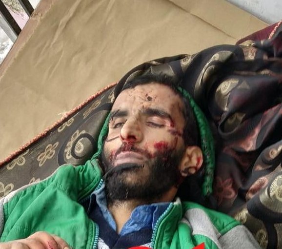 Shopian Encounter: One among two slain identified as civilian