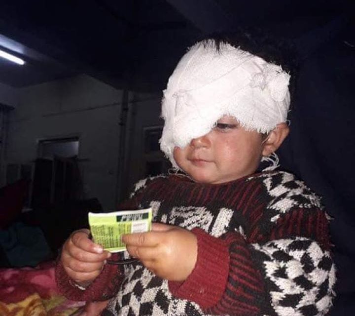 Rs 1 lakh assistance provided to pellet victim Hiba