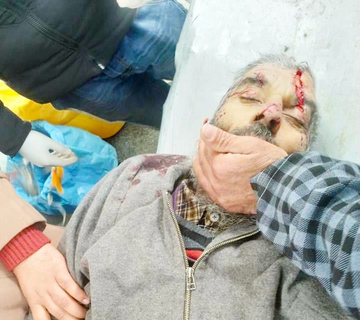 Scooty rider dies in tragic Road Accident at Kurhama Bypass In Ganderbal