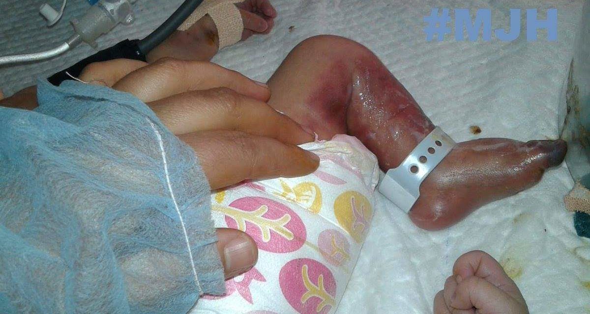 Kreeri family alleges their new-born died of ‘blower heat’ at GB Pant hospital