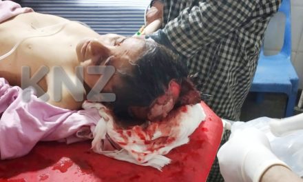 Stray dogs mauls minor boy In Kangan