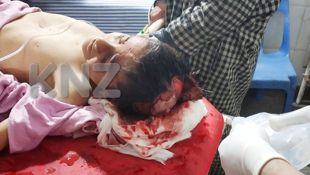 Stray dogs mauls minor boy In Kangan