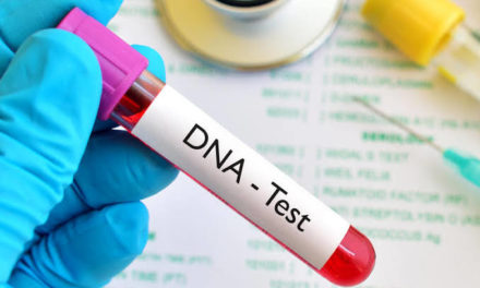 DNA test to identify slain militants as bodies ‘beyond recognition’