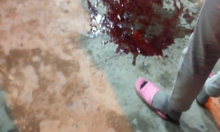 ﻿Policeman injured critically in Srinagar militant attack