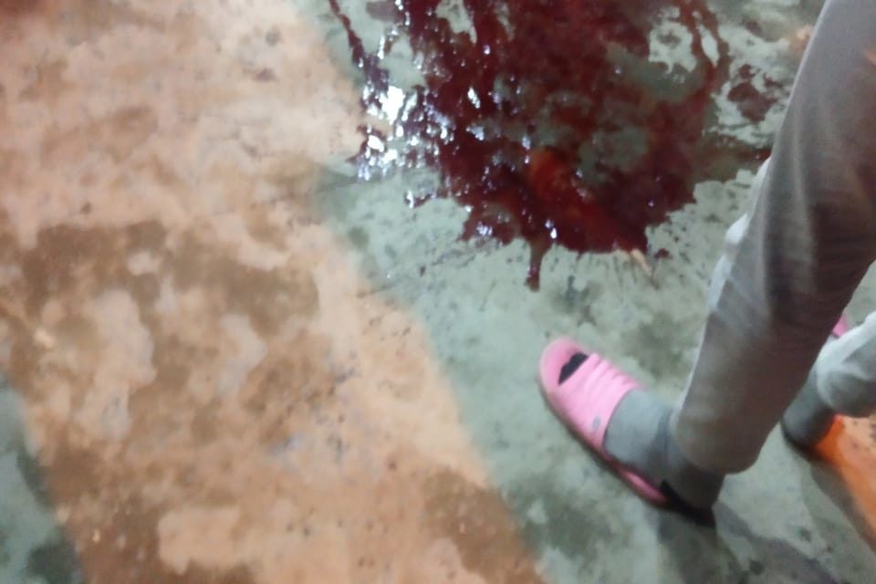 Policeman injured critically in Srinagar militant attack