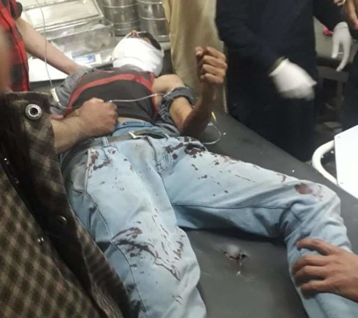 Two civilians injured after army opens fire in Pulwama