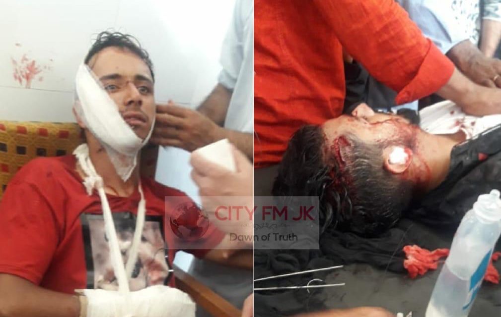 Two Youths Injured in Shopian Accident