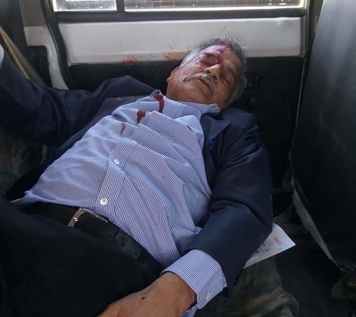 Medical Superintendent Gandhi Nagar hospital injured in Nagrota road mishap