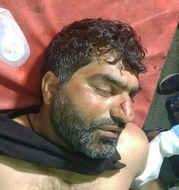 Injured retired Army man of Kulgam succumbs