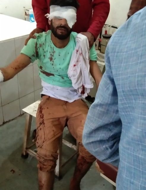 Youth injured after mobile explodes in his hands in Tral