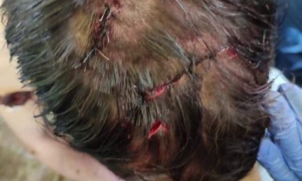 Man critically injured in bear attack in Budgam