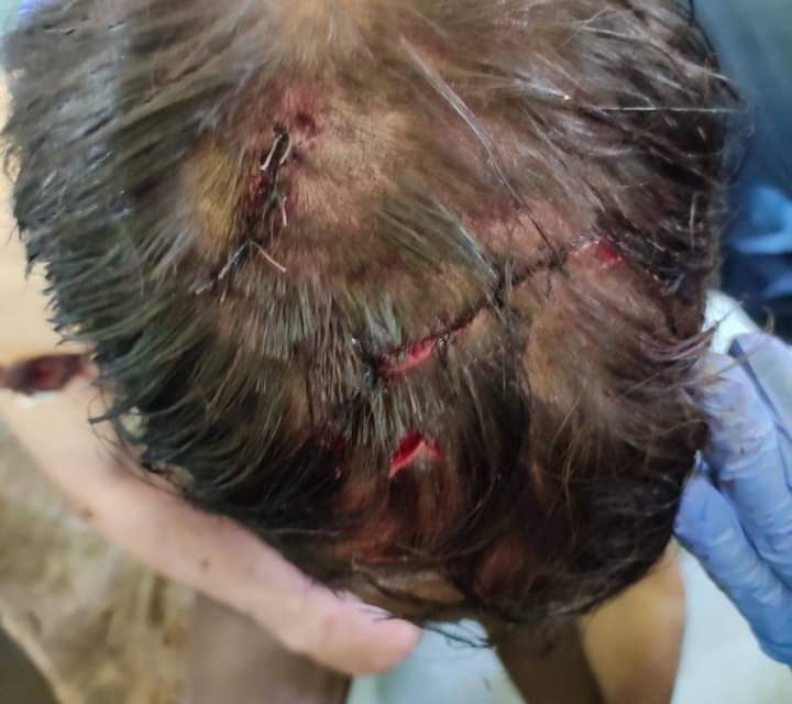 Man critically injured in bear attack in Budgam