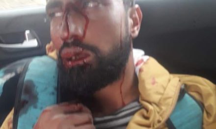 Policeman injured in accident in Handwara