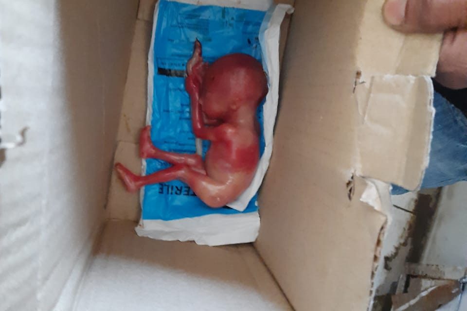 Shocking : Newborn baby found dead in Trauma Hospital Kangan