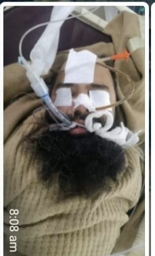 Militant who was critically injured in Anantnag gunfight succumbs