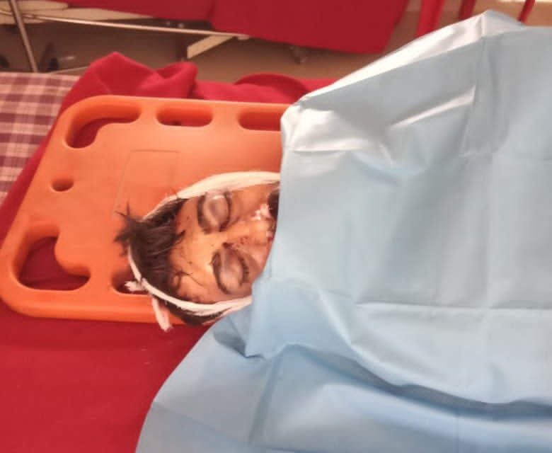 Driver dies after tractor turns turtle in Central Kashmir’s Budgam, boy injured