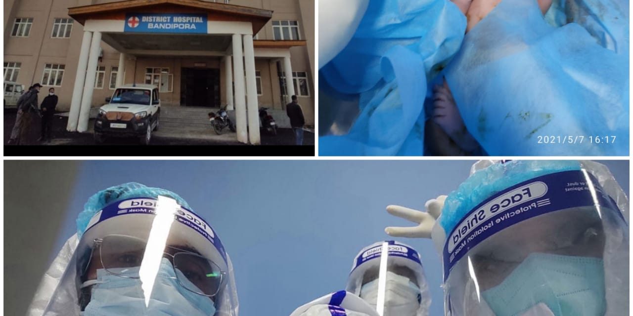 COVID Positive patient with comorbidities delivers healthy baby after rare surgery at DH Bandipora