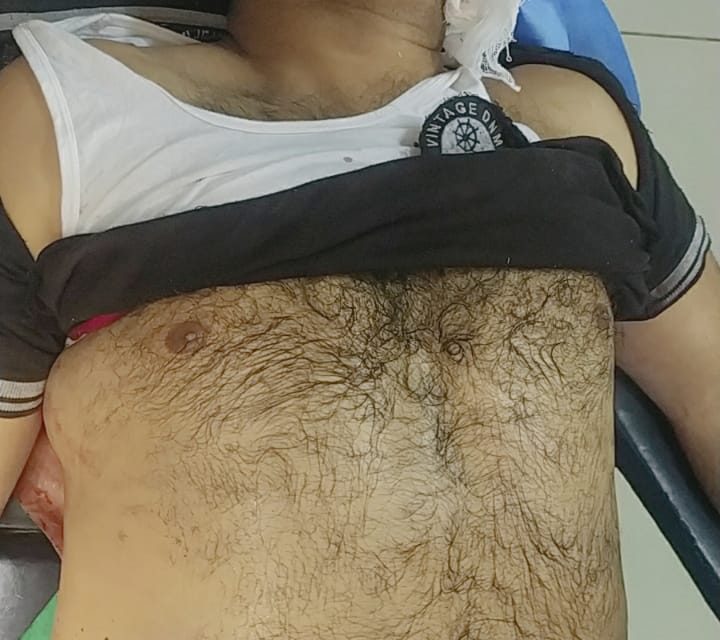 Nowgam Incident: 2 Militants Killed CID Inspector By Firing With Pistols: Police