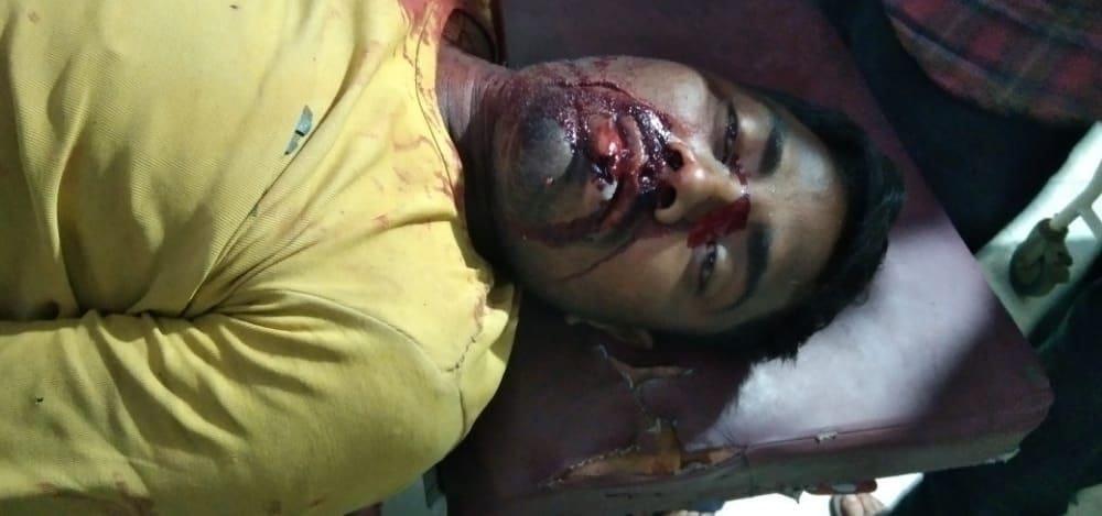 Non-Local Labourer Shot Dead In Kulgam