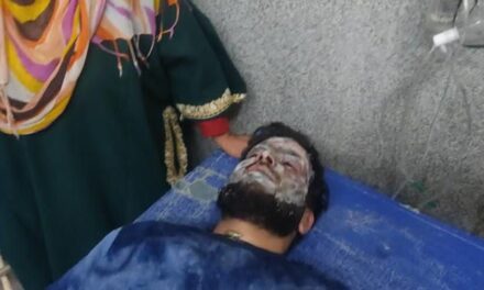 2 Technicians Sustain Burn Injuries in Oxygen Plant Leakage in GMC Baramulla