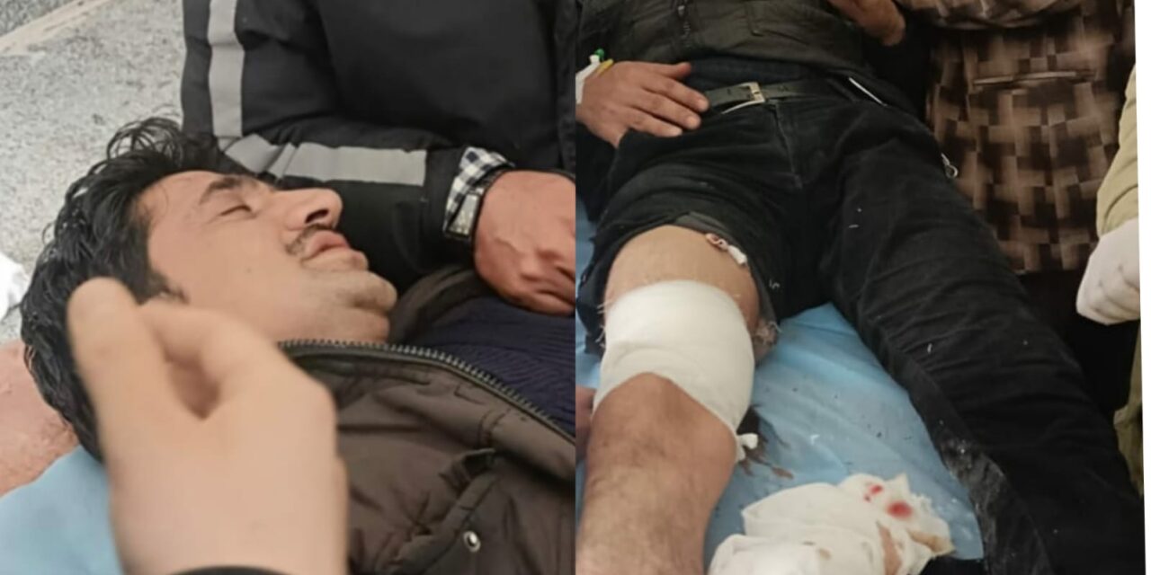 Bank Guard Injured In Militant Attack In Pulwama