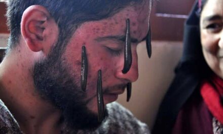 Beelines for leech therapy on Novroz Eve