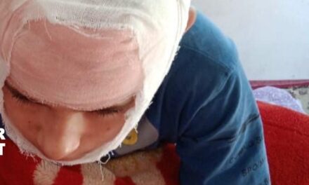 Beaten up by teacher class 5 student receives four stitches on head in Kashmir