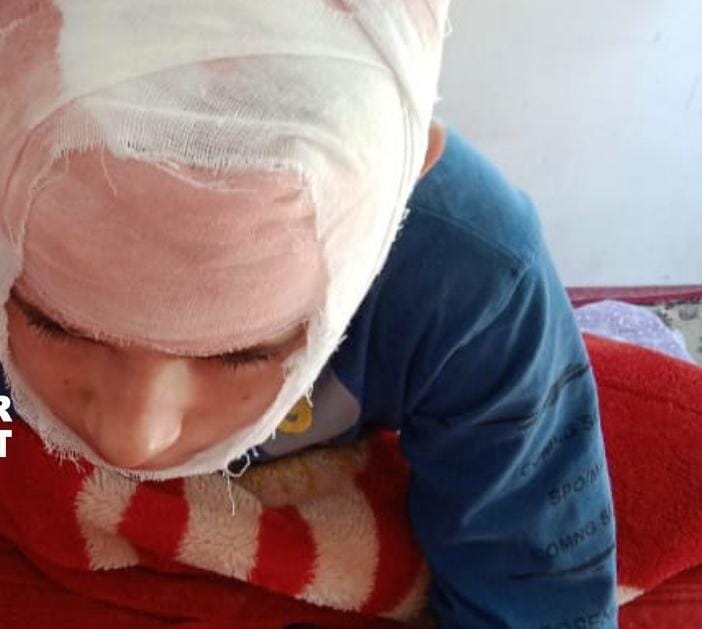 Beaten up by teacher class 5 student receives four stitches on head in Kashmir